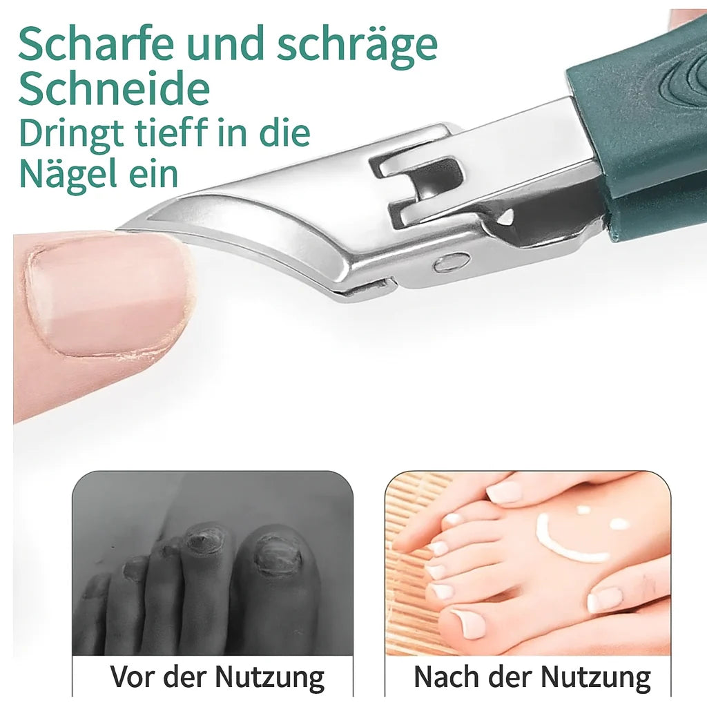 NailCut™ – Precise Care for Problem Nails