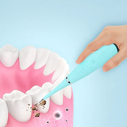 SonicSmile™ – Professional Ultrasonic Dental Care for Home Use