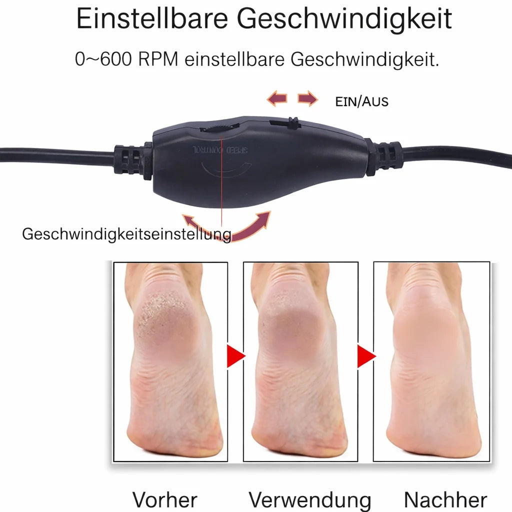 SilkStride™ — Instantly Silky Smooth Feet Without Pain or Effort